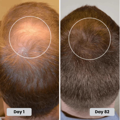 Red Light Therapy Cap for Hair Regrowth